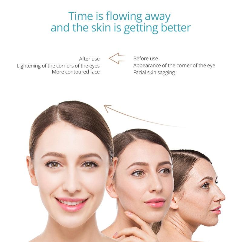 Skin Rejuvenation Anti-wrinkle EMS RF Skin Care Clean Tighten Lifting Facial LED Photon Radio Frequency - MyStoreLiving