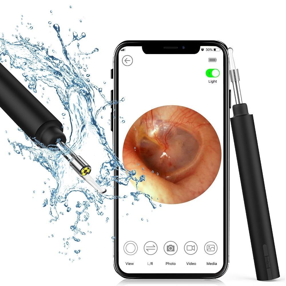 Ear Wax Remover Otoscope Ultra-Thin - MY STORE LIVING