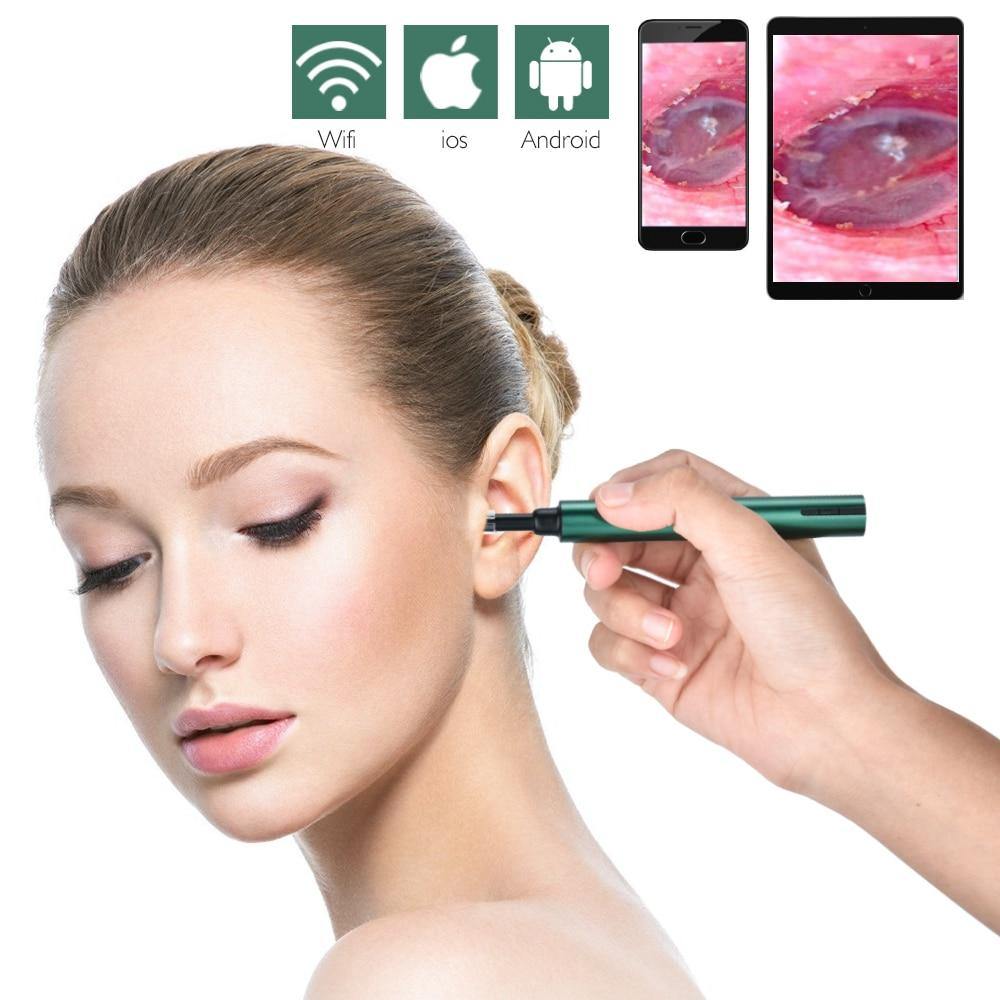 Ear Wax Remover Otoscope Ultra-Thin - MY STORE LIVING