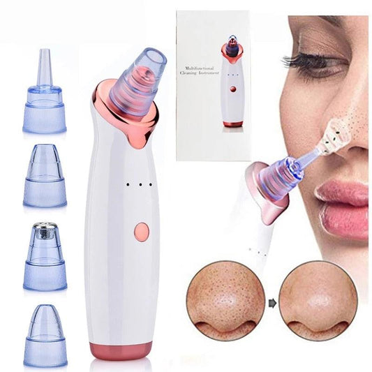 Blackhead Remover Vacuum Suction Cleaner - MyStoreLiving