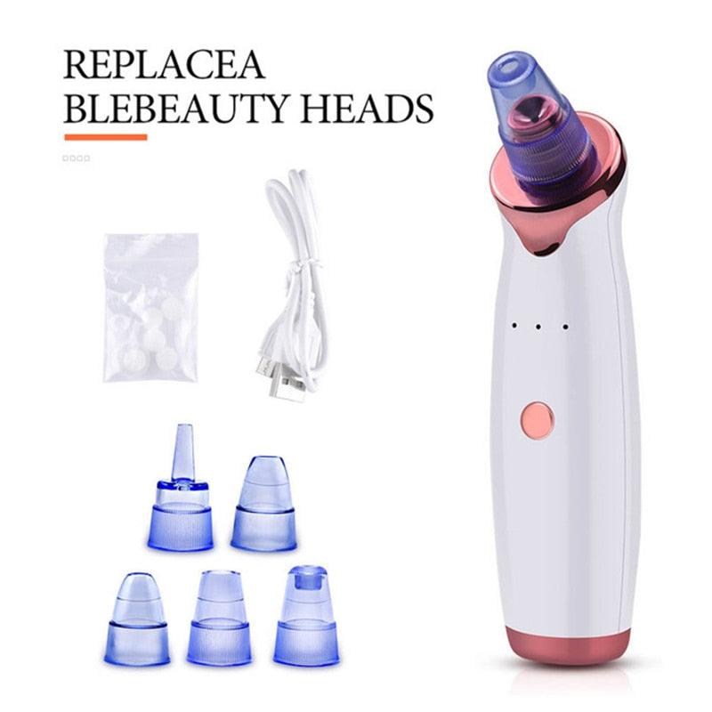 Blackhead Remover Vacuum Suction Cleaner - MyStoreLiving