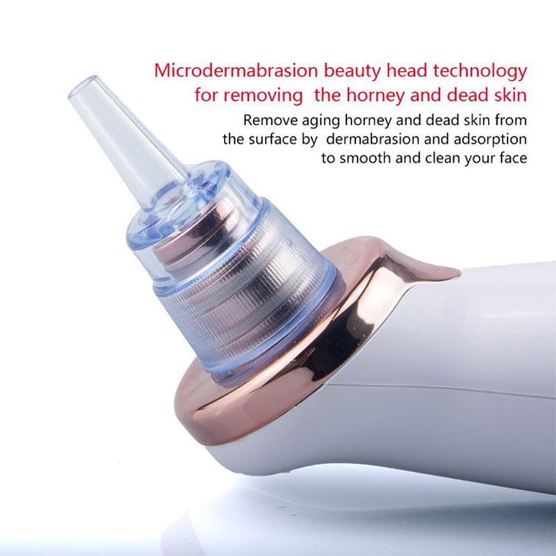 Blackhead Remover Vacuum Suction Cleaner - MyStoreLiving