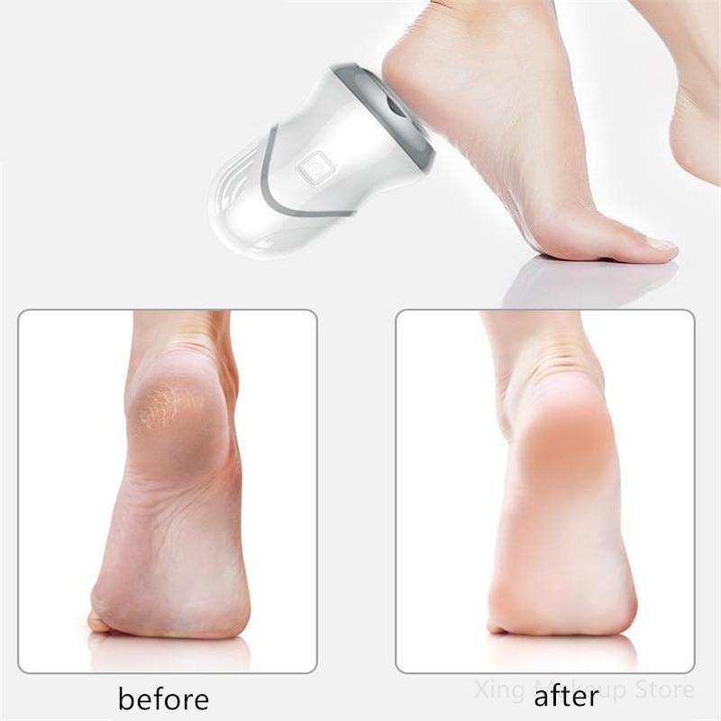 USB Charging Electric Foot Massager - MY STORE LIVING